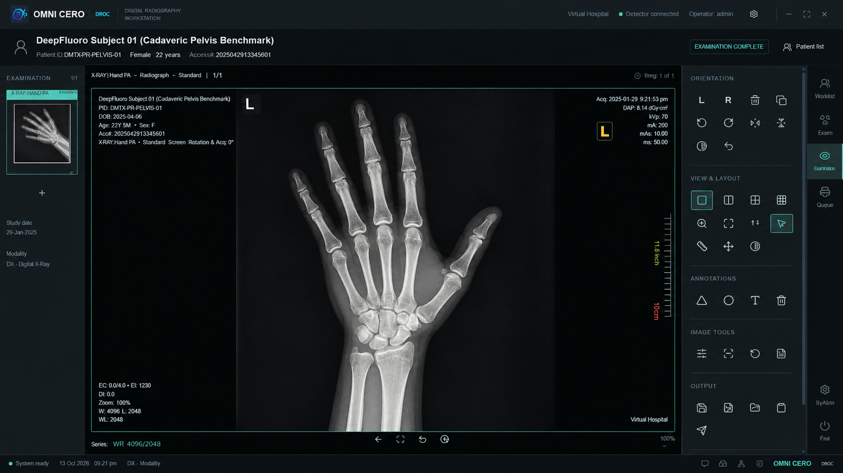 OMNI CERO DROC clinical interface