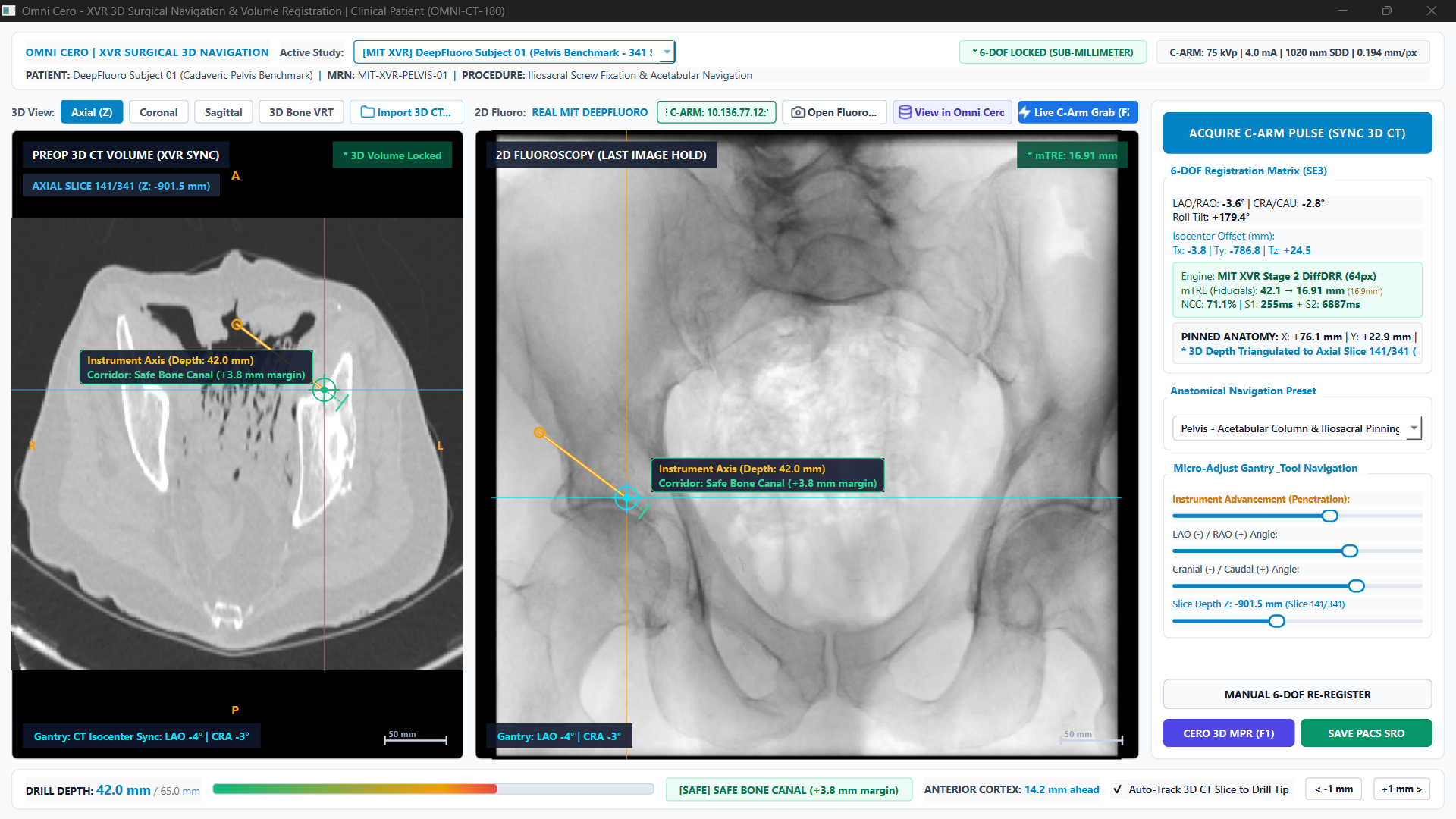 CERO XVR clinical interface
